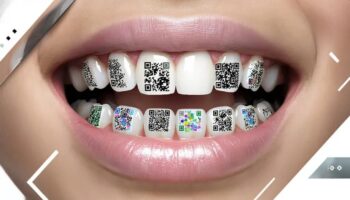 QR код на зубах